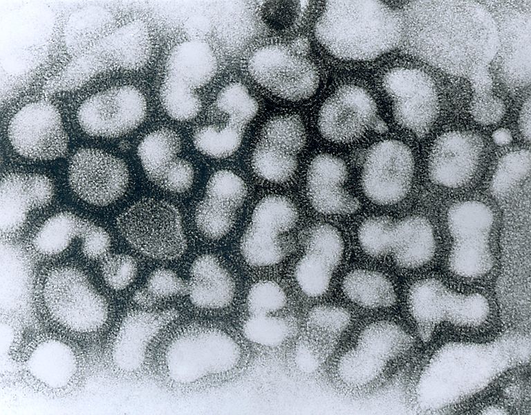 By Photo Credit: Content Providers(s): CDC/ Dr. Erskine Palmer [Public domain], via Wikimedia Commons